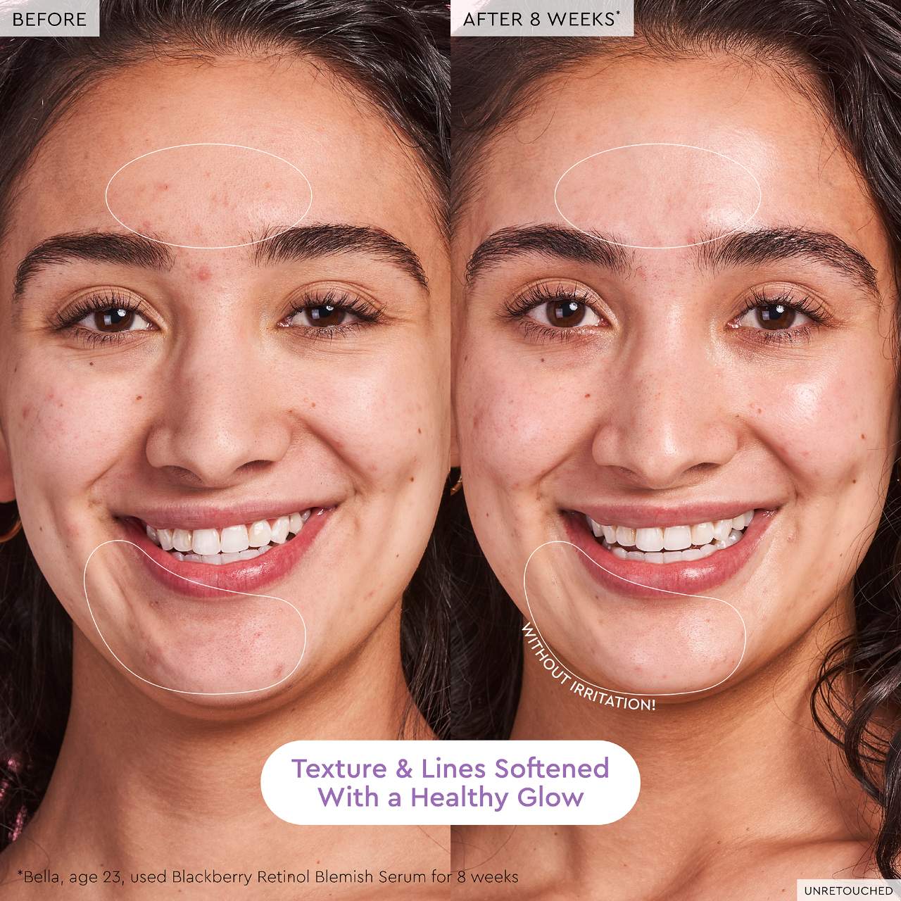 Glow Recipe Blackberry Retinol Blemish Serum 3