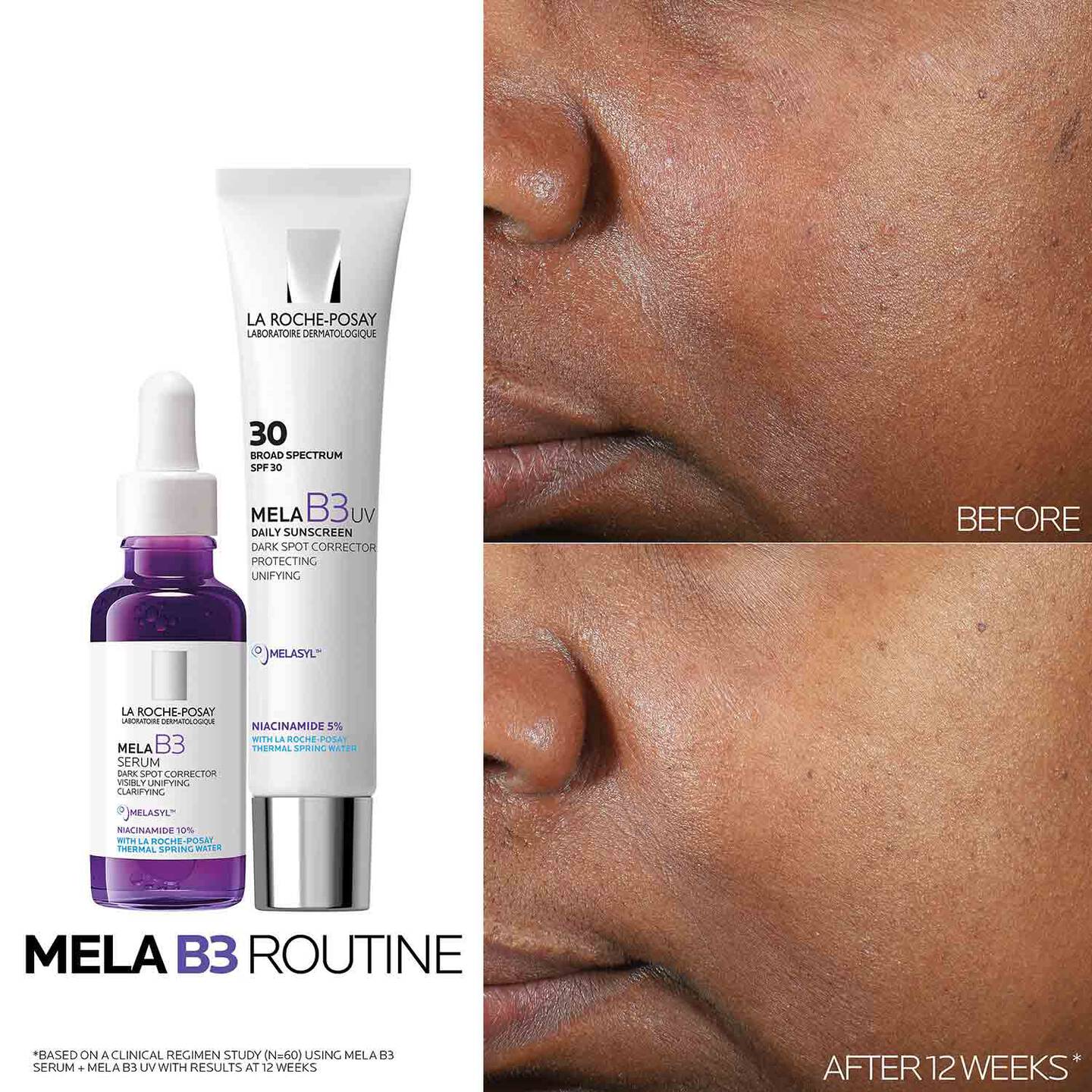 La Roche Posay Mela B3 Dark Spot Serum With Melasyl™ + Niacinamide 6