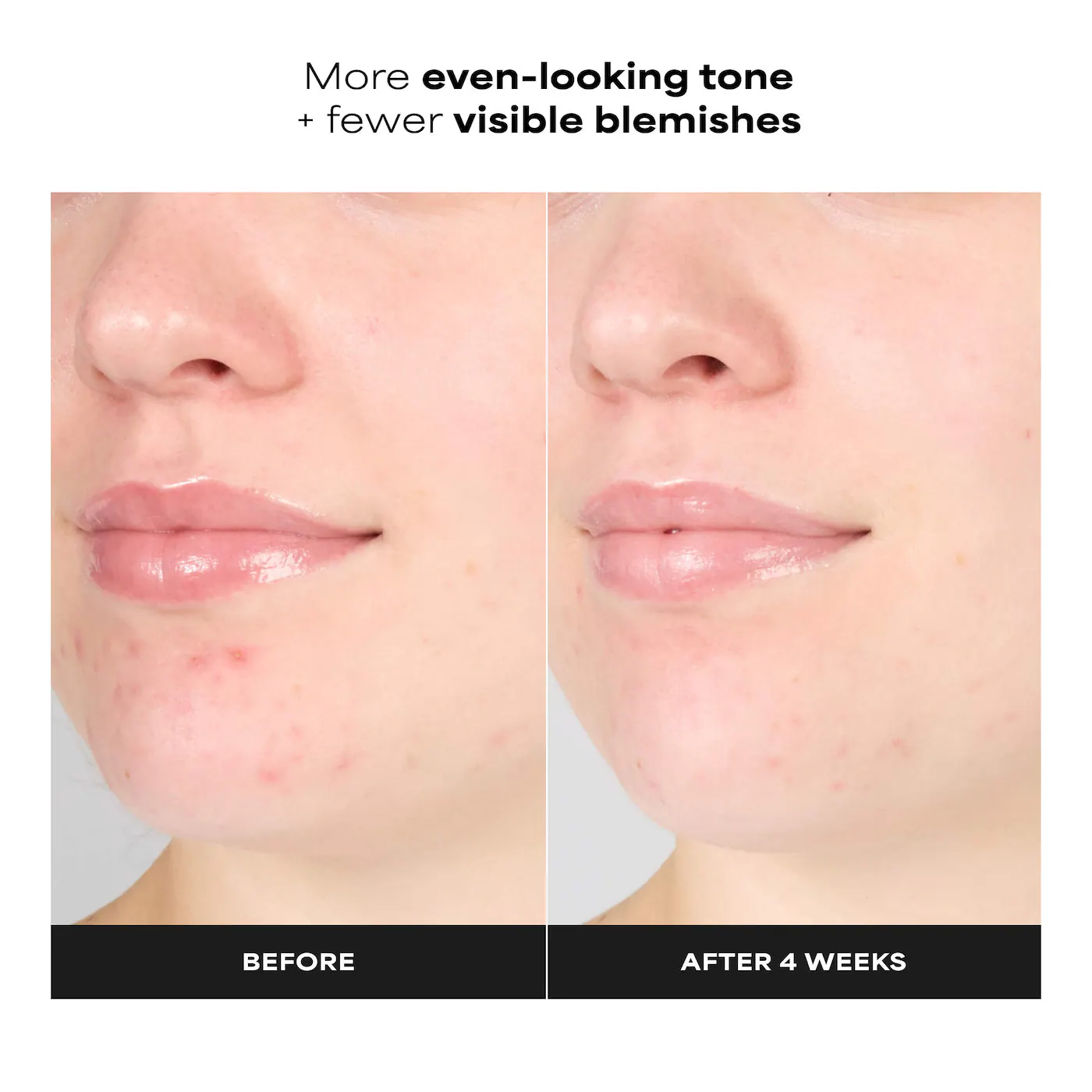 Paula's Choice  Skin Perfecting 1% BHA Gentle Exfoliating Gel Toner for Sensitive Skin 2